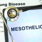 Asbestos: What is Mesothelioma? - Amity Environmental - Asbestos Inspection Calgary